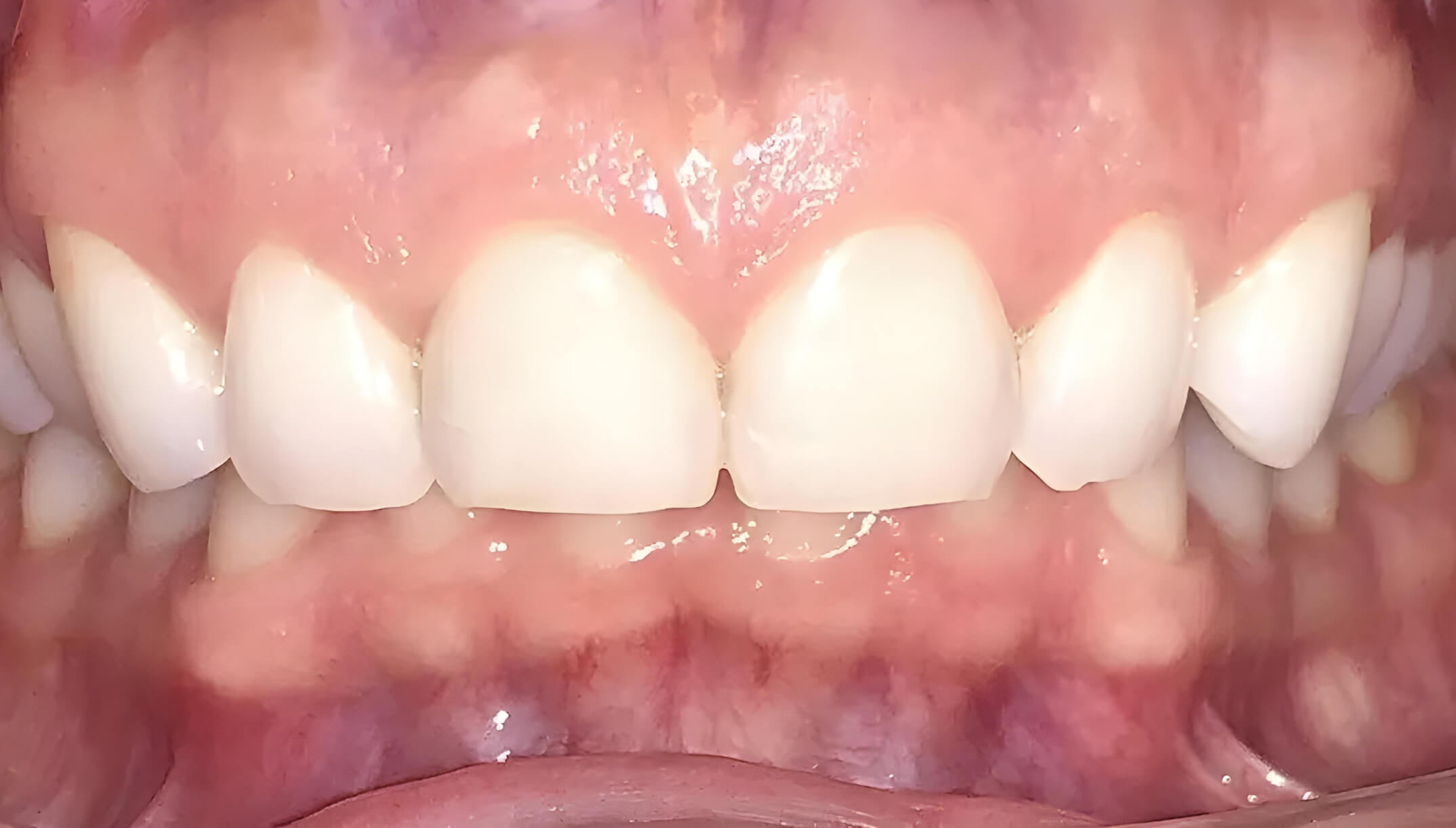 Before